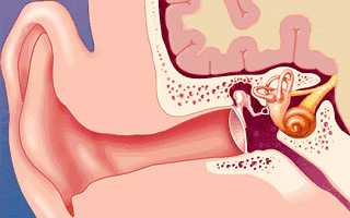 Что такое отосклероз и чем он опасен?