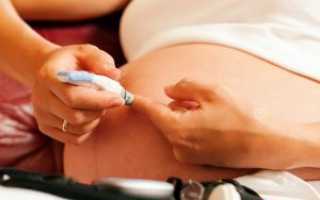 Глюкоза при беременности: поддержание в норме