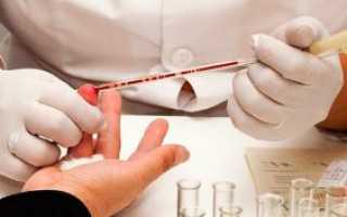 Подготовка к сдаче анализа крови на сахар и его расшифровка