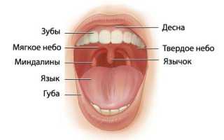 Казеозные пробки