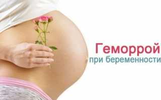 Геморрой при беременности: как вылечить болезнь в домашних условиях