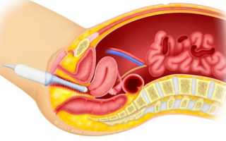УЗИ во время месячных: делают или нет, все за и против