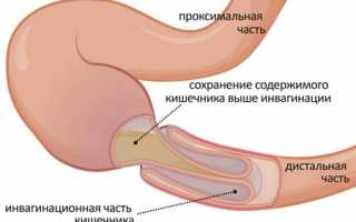 Порядок действий при боли в животе и поносе