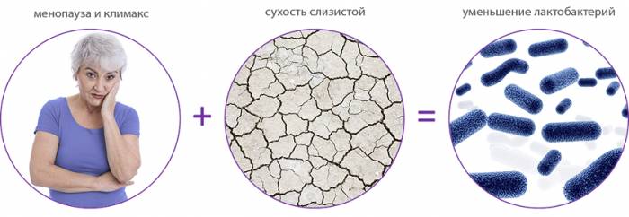 Факторы развития недержания при климаксе