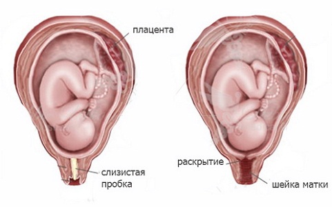 Кровотечение со слизью при беременности