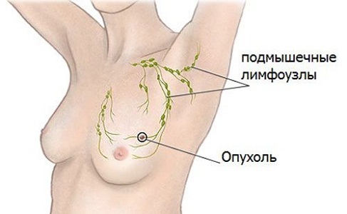 Лимфатические узлы в подмышках перед месячными