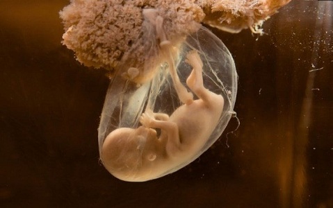Менструальный цикл после замершей беременности