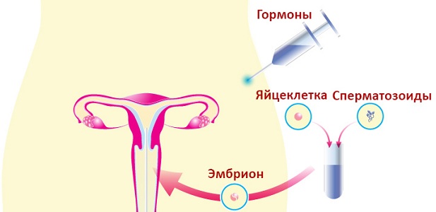 Менструация после процедуры ЭКО