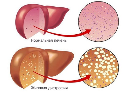 Органический фактор недостаточности лютеиновой фазы