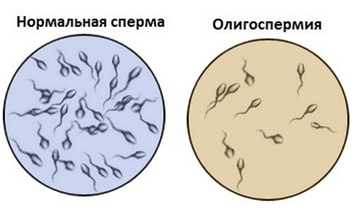 Подготовка к стимуляции овуляции Клостилбегитом