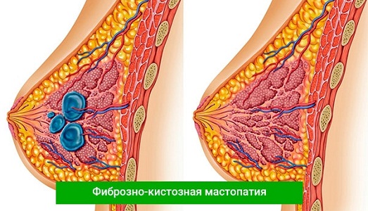 Показания к применению препарата Индол