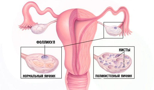 Причины низкой базальной температуры