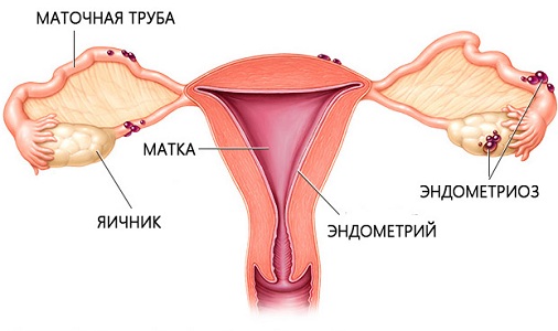 Причины выделений после гинекологического осмотра