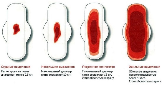 Признаки меноррагии