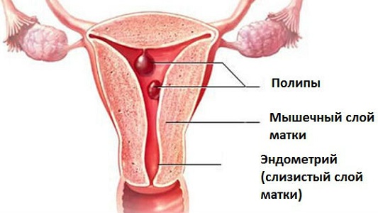 Признаки патологической боли живота перед месячными