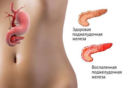 Противопоказания Белары