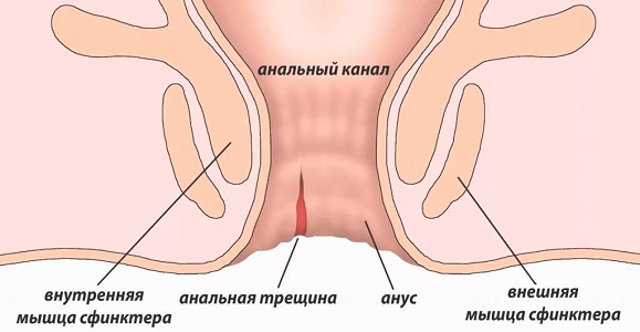 Противопоказания колоноскопии при месячных и беременности