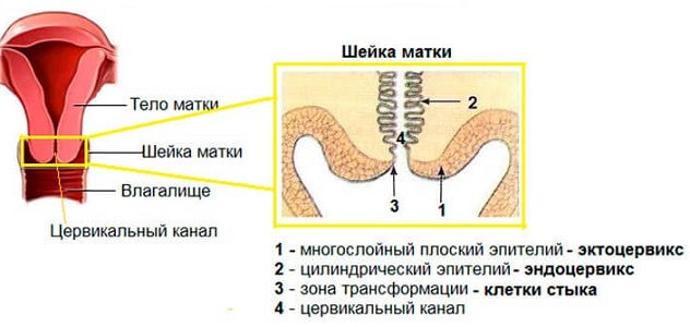 Шейка матки при дисплазии