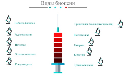 Виды биопсии шейки матки