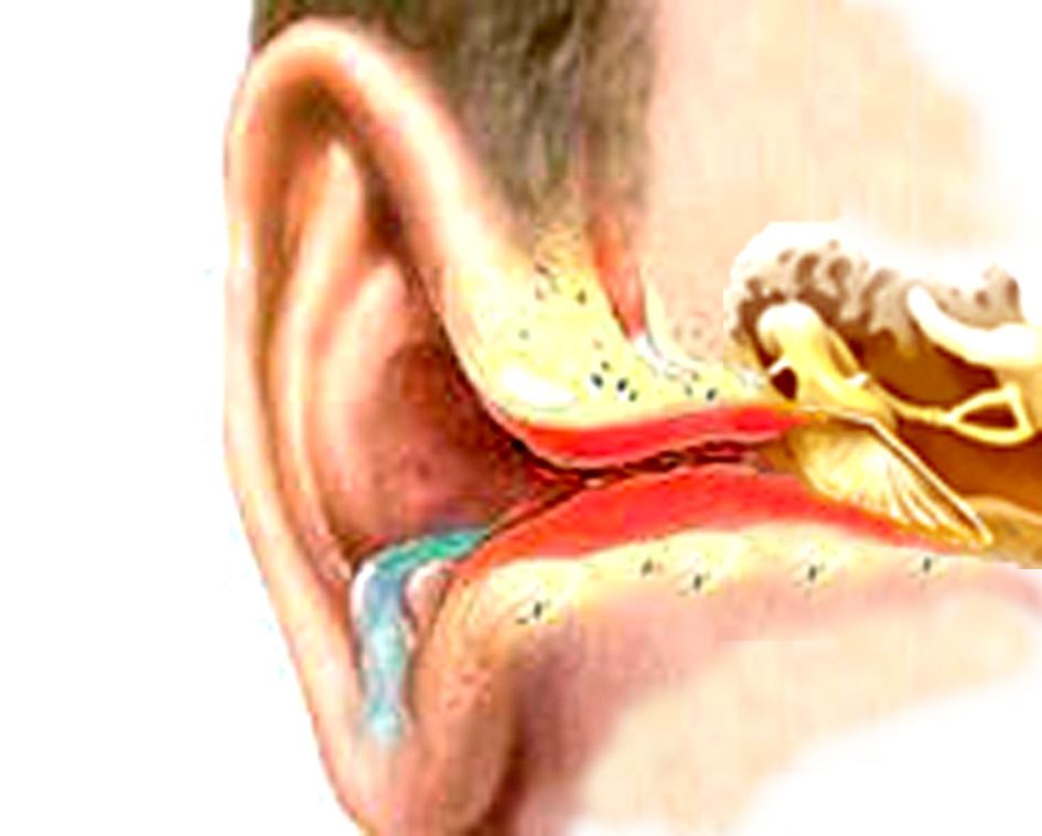 Место воспаления при наружном отите