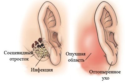 Образование шишки за ухом