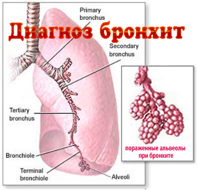 схема бронхов и расположение в легком