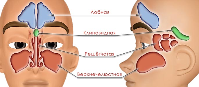 Панинусит хронический